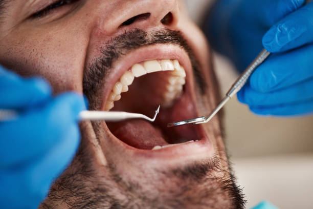 Best After-Hours Emergency Dentist in Long Creek, IL